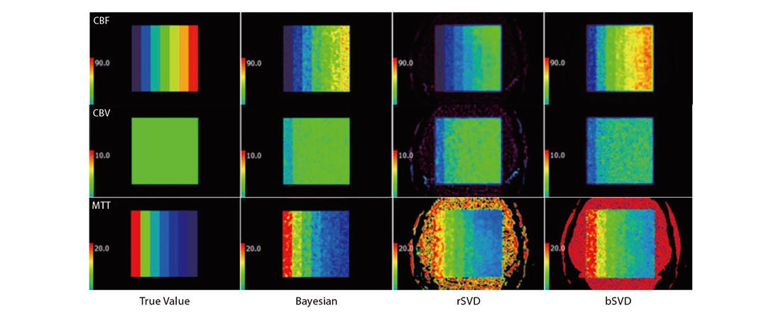 2020WP-Bayesian-CT-Perfusion-Imaging-in-Ischemic-Stroke