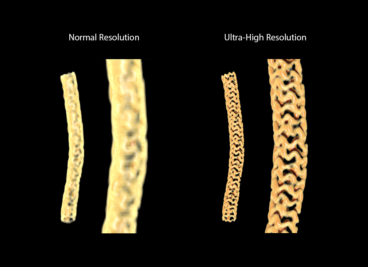 Coronary Stent